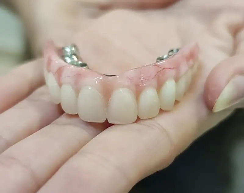 Prótese protocolo real apresentada nas mãos