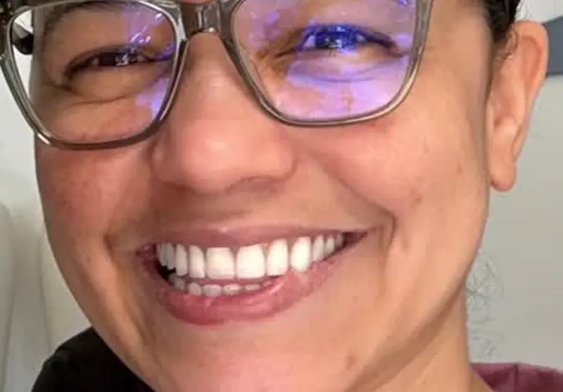 Sorriso do acervo OdontoSan; não indica realização de clareamento